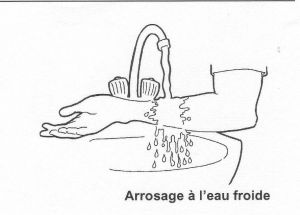 Faire couler de l’eau tièdefroide sur la brûlure